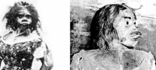 原创女子生下像猿人却被多人求婚去世后还被做成标本赚钱