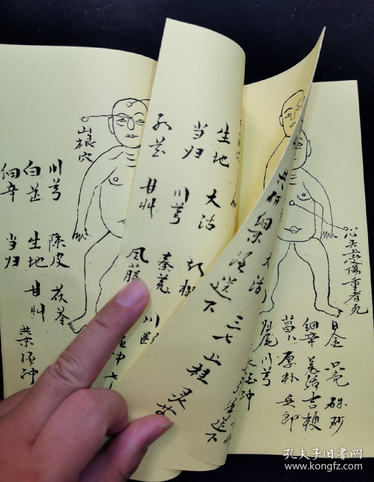 字门拳:练手余功全圖秘法,武功点穴跌打药薄,人物穴位精绘图