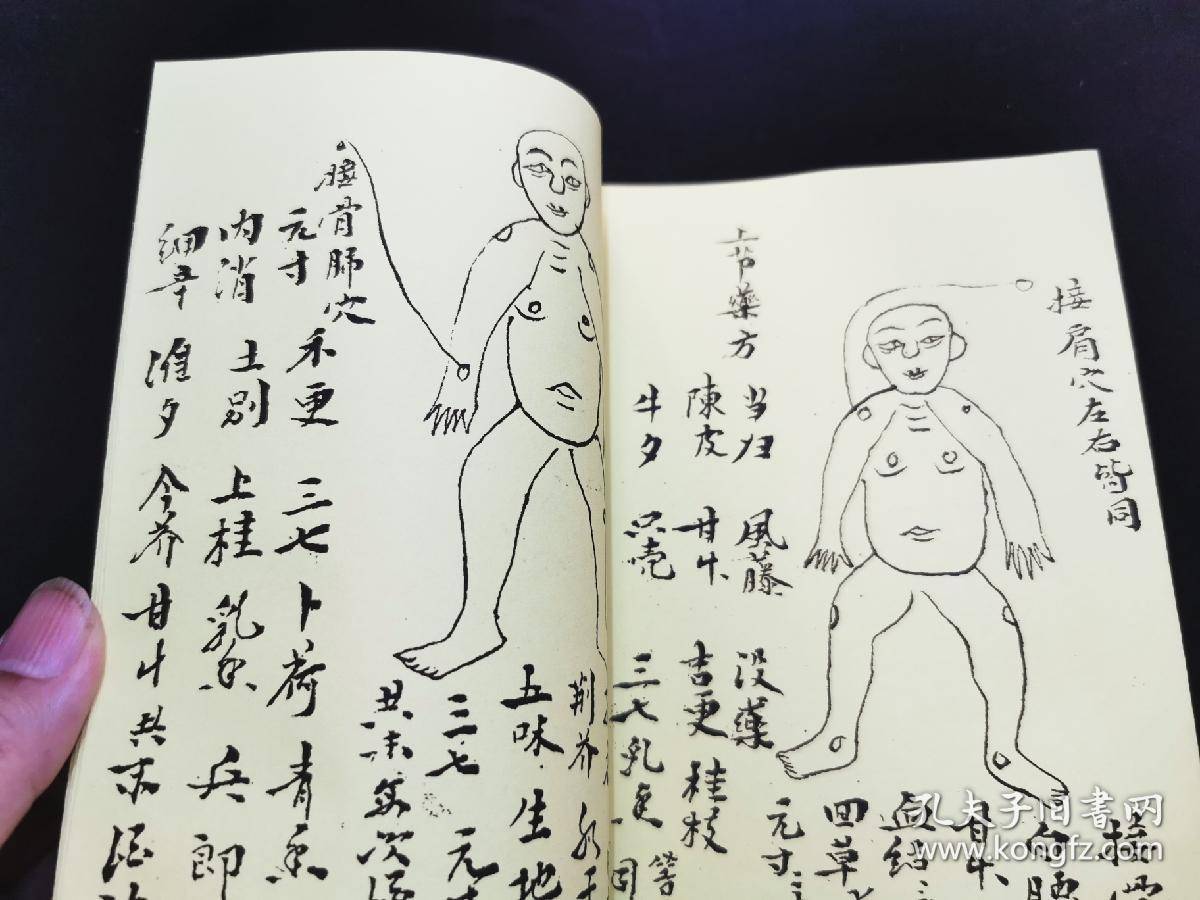 字门拳:练手余功全圖秘法,武功点穴跌打药薄,人物穴位精绘图