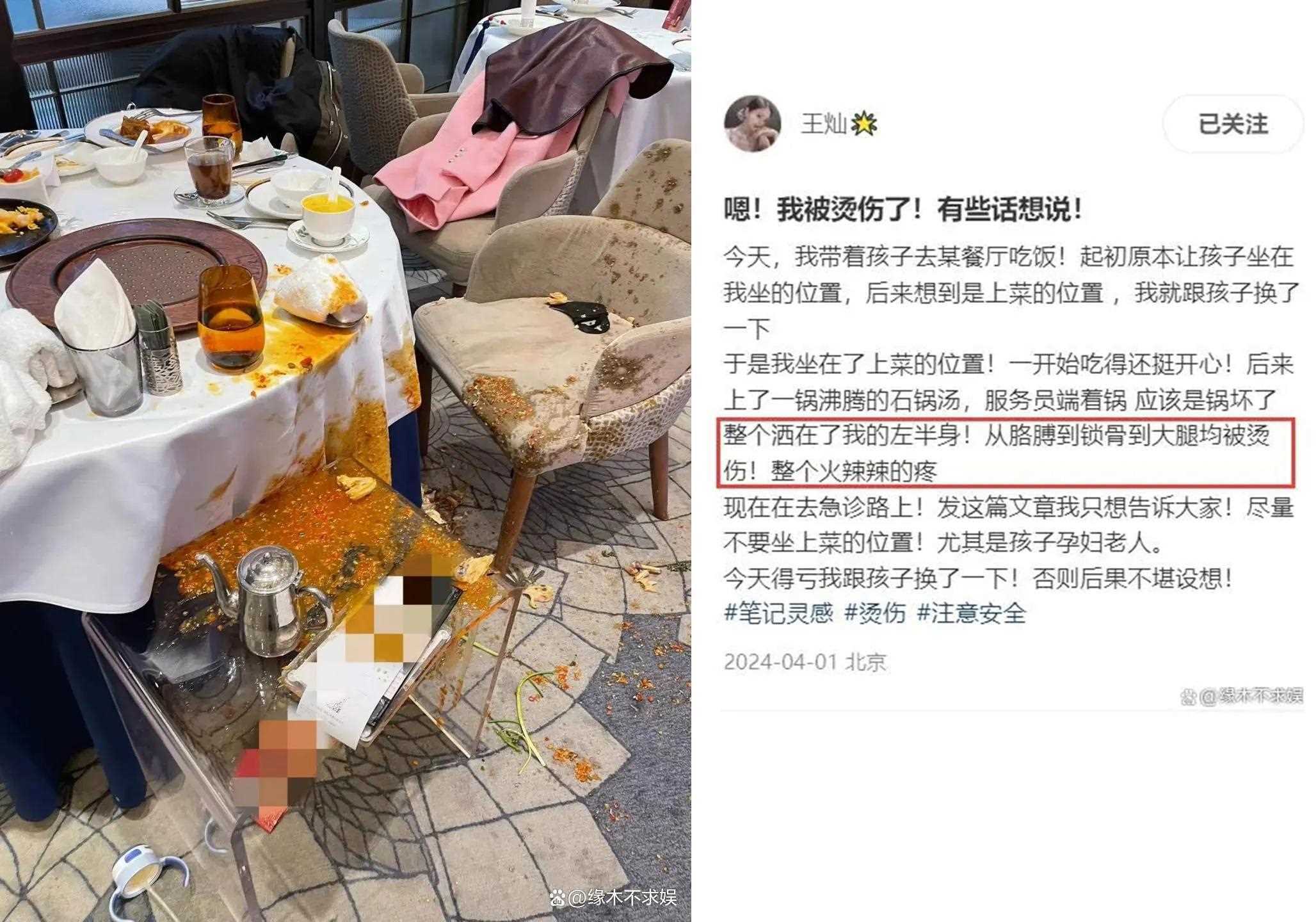 杜淳老婆烫伤后续带货回应引争议伤痕明显
