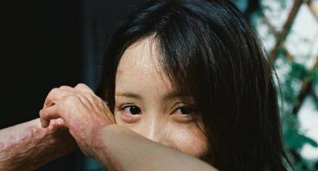 原创安徽16岁少女周岩因拒绝官二代被泼汽油毁容如今过得还好吗