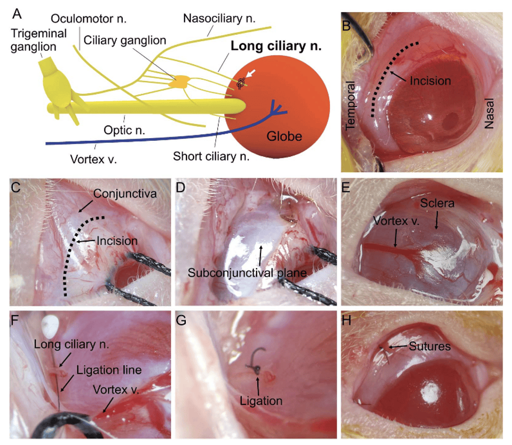 复旦大学眼耳鼻喉科医院李文献/韩园团队构建神经病理性角膜痛新模型