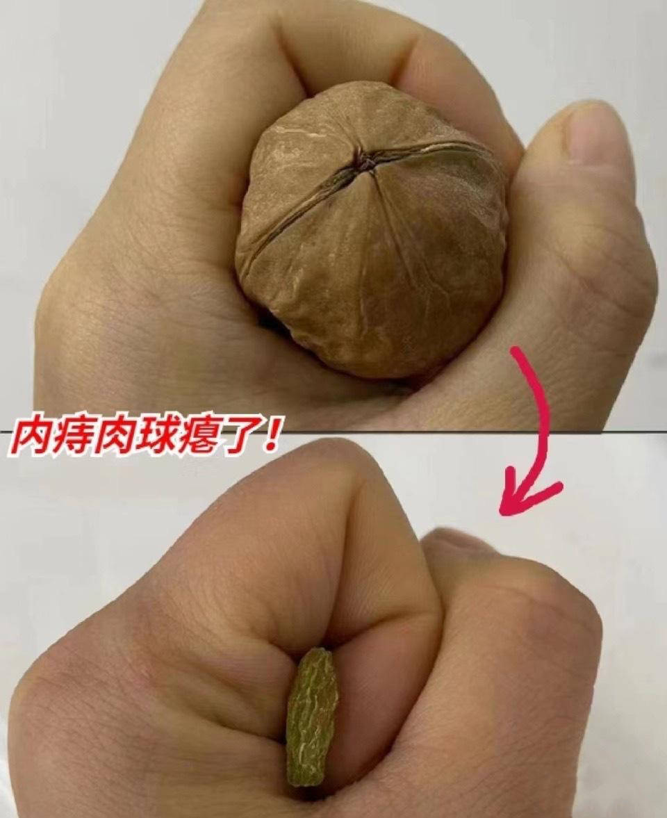 经验分享,25天内痔疮肉疙瘩全都没了!_感觉_肛门_凝胶