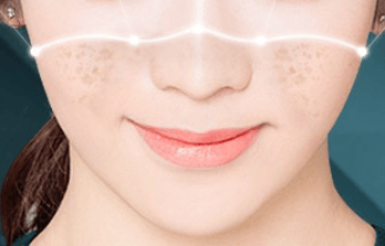 看~超皮秒激光祛斑的危害与效果,超皮秒激光祛斑后注意哪些事项