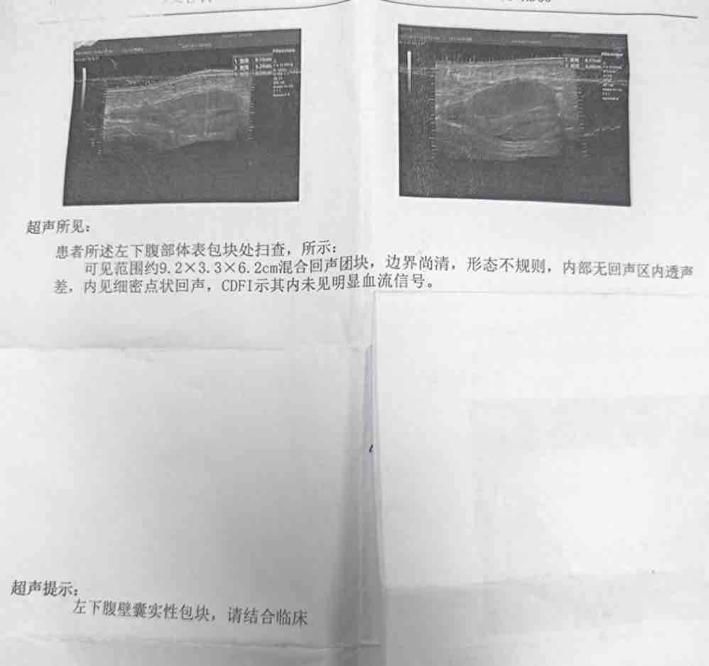 8月,为了得到更准确的答案,邓女士在前往一家公立三甲医院进行b超检查