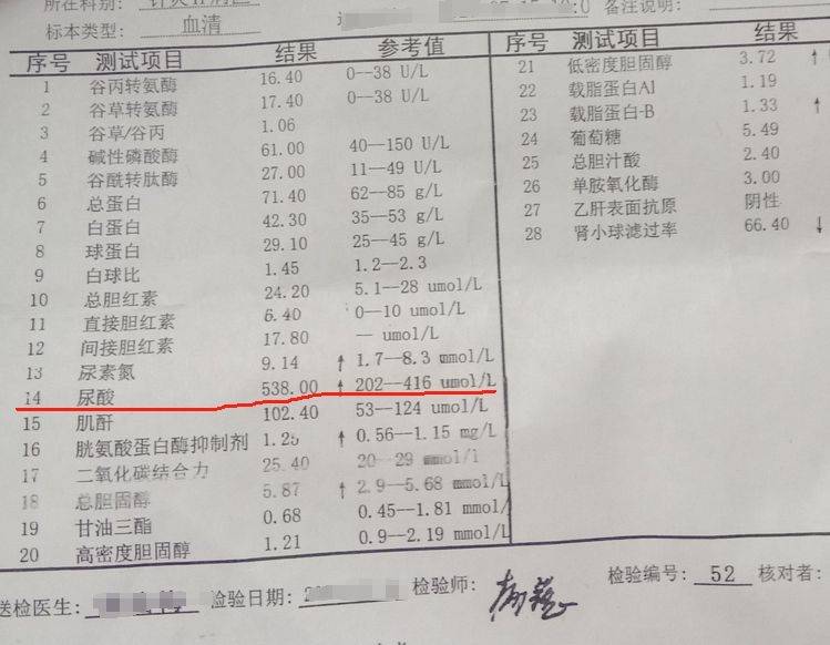 化验单体检尿酸高得吓人你知道怎么治疗吗痛风专家张卓教你