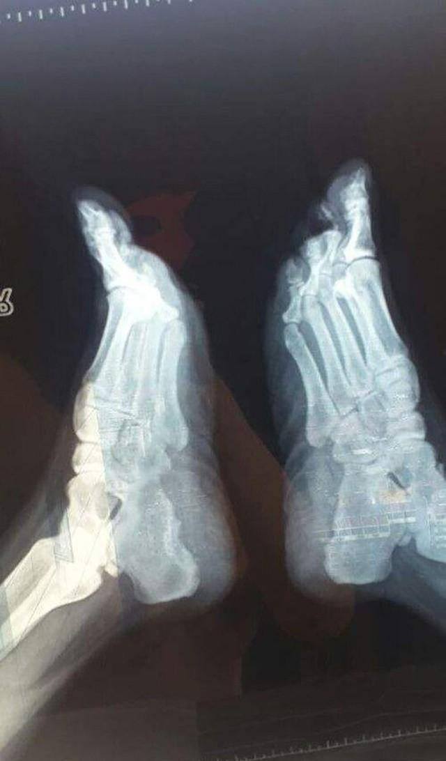 红粉宝宝的脚在她的成长过程中,既缺乏父母的关爱,又缺少适当的教育