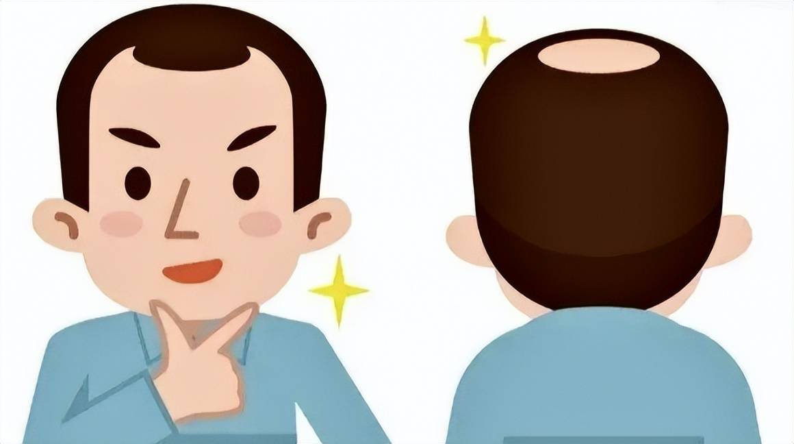 相信脱发是很多人都会有的困扰,发际线变高,头顶稀疏,不仅影响颜值