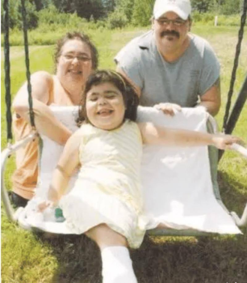 现实版"美人鱼",出生时下肢粘连,生存10年创医学奇迹