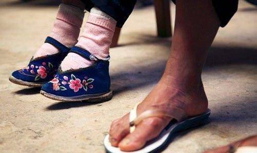 民国小脚夫人:靠小脚嫁人,每次洗脚疼痛难忍,却不说怕丈夫厌弃