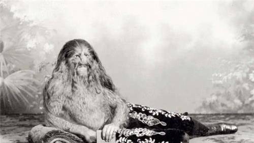 欧洲真实的"半狮半人":加入马戏团后走红成百万富翁,结局如何