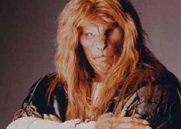 真正的"半狮人":因怪异外形红遍欧洲,精通5国语言却不幸早逝