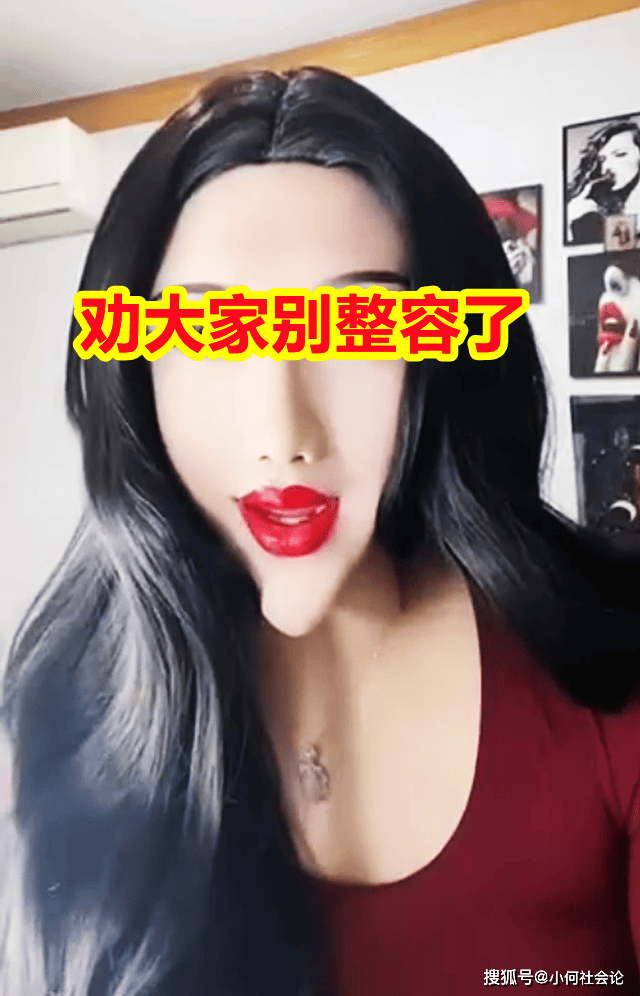 后悔莫及!女子整容失败,瓜子脸变锥子,称家人看了都害怕