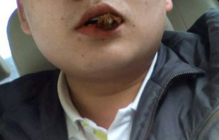 长期食用"它",容易患口腔癌,出现以下3种症状,需警惕!