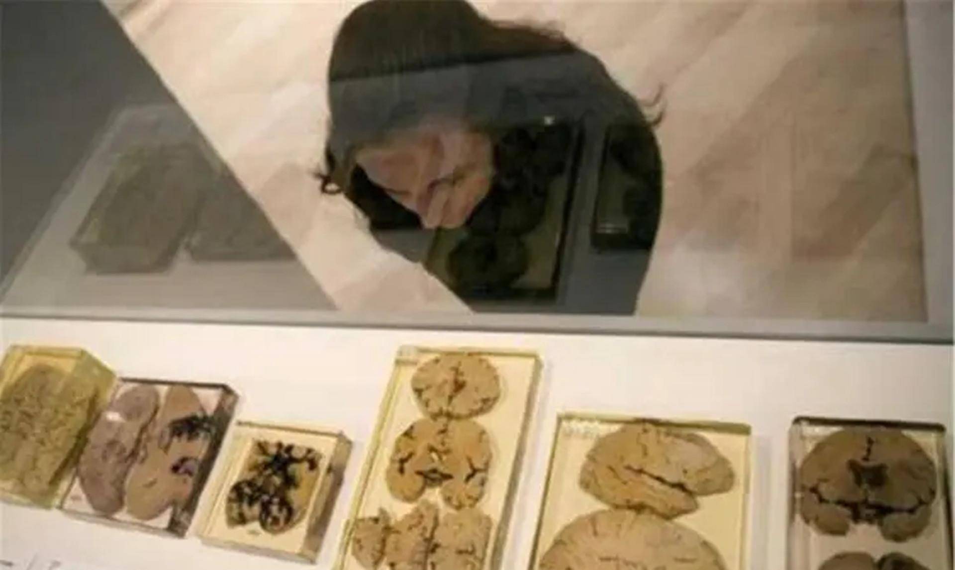 66年前,哈维偷走爱因斯坦的大脑切成240块研究,结果如何?