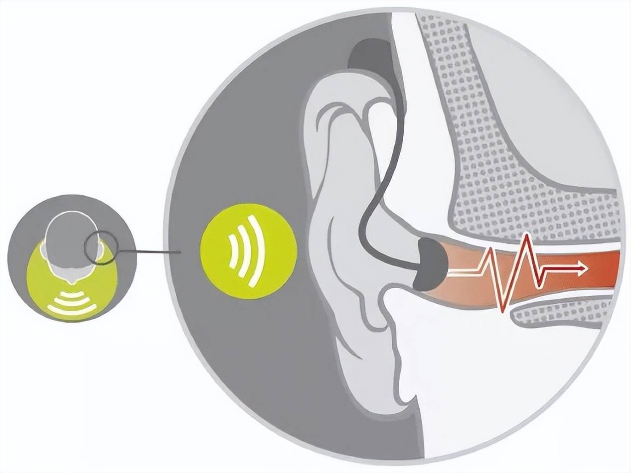 开放式耳机什么牌子更好?这里有几点你需要注意!