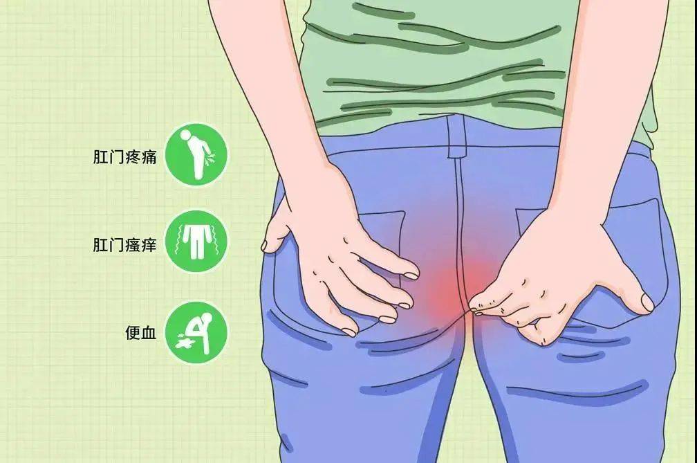【广州建康医院是正规的】肛瘘常见的五大症状表现
