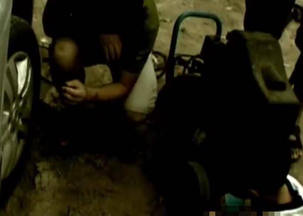 12年,山东男孩被工友开玩笑,用高压泵往体内充气,五脏严重损坏