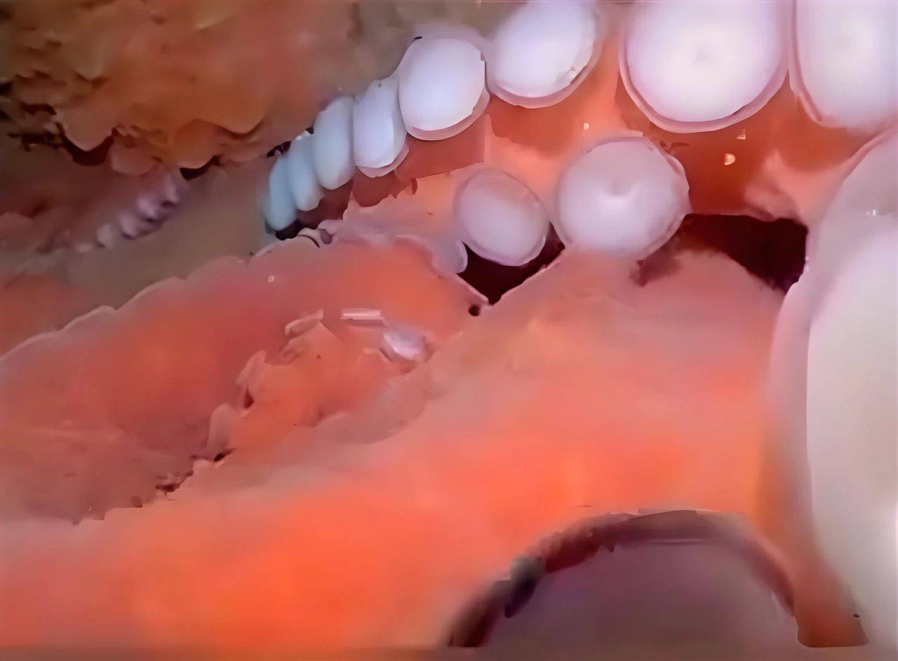 日本出现巨型章鱼,变异疑虑与核污染猜想交织