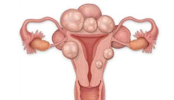 身体_月经_子宫