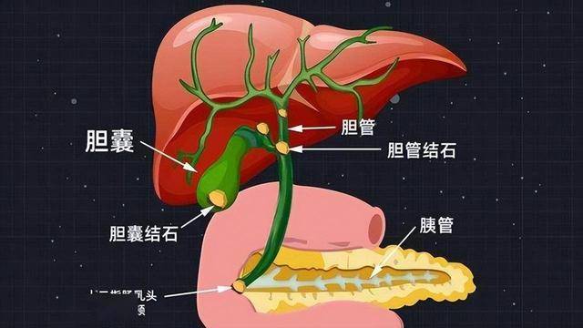 胆囊切除后,有哪些后遗症?医生:5种"结局"或不好受,了解下