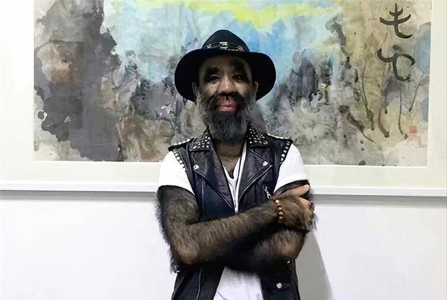 "毛孩"于震寰:浑身是毛,刚出生就被研究,41岁迎娶90后娇妻