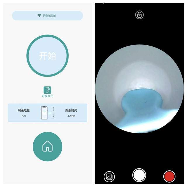 西圣Find智能可视耳勺:科技革新,让掏耳更智能更安全