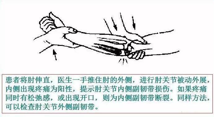 肘直线(4)肘关节外部形状检查(3)冈上肌断裂检查患肢肘关节屈曲9002