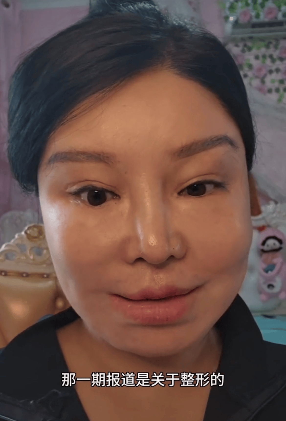 41岁红粉宝宝最新近照曝光,被嘲像80岁,欲卖300万房产继续整形