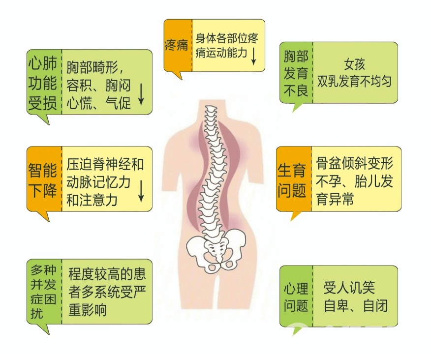 徐州矿务集团总医院针对儿童常见的含胸驼背,高低肩,骨盆前倾,x型腿,0