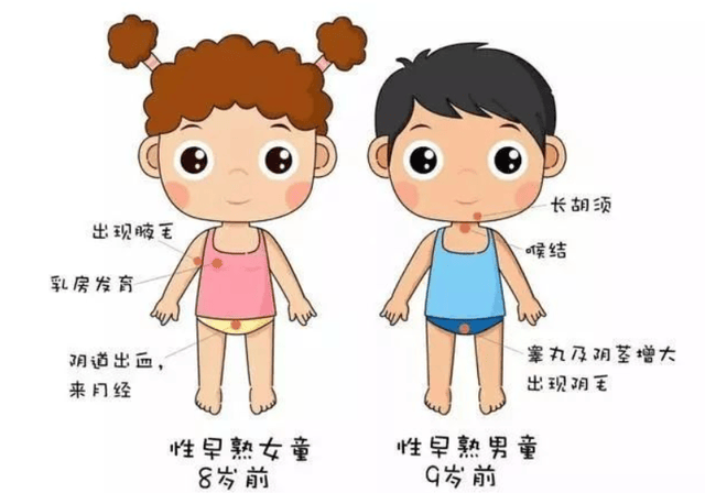 在孩子进入青春期之前,过早的第二性征开始发育,比如:体格发展过快,与