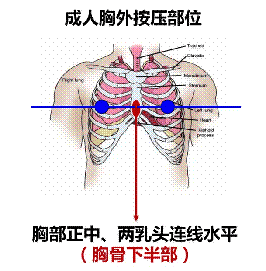 胸骨下陷5～6厘米(成年人),每次按压后胸廓充分回弹,双手不离开胸壁