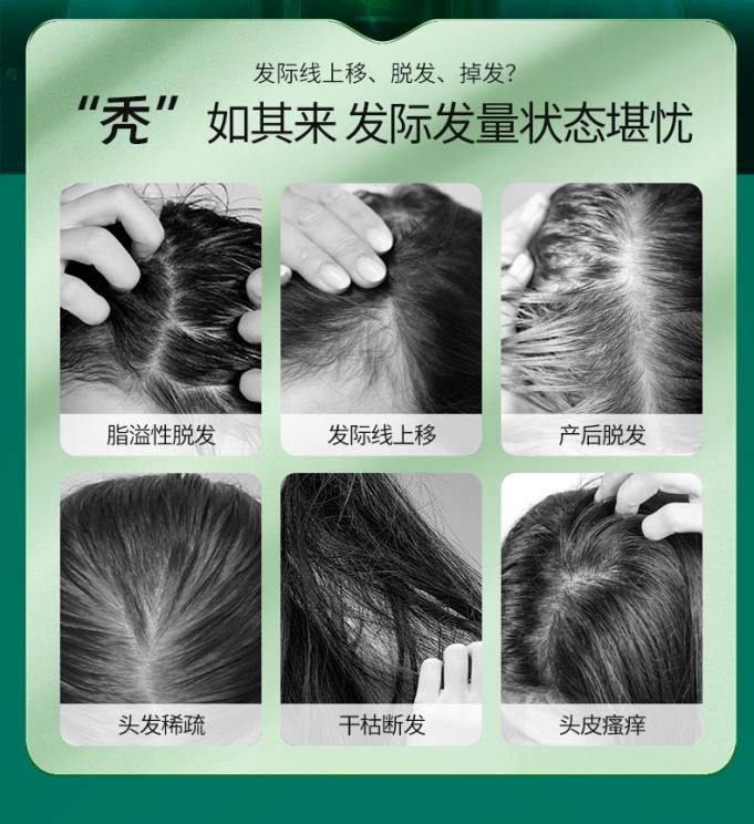 油腻,按摸两下秒渗透,可帮助深层滋养头皮,毛囊,周期使用头发越发浓密