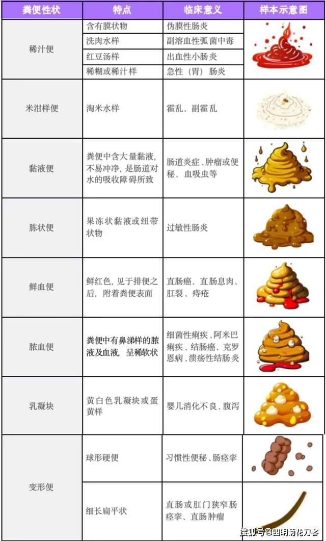 宁波肛肠专家—彭联明主任谈:怎样知道你的大便真的健康吗?