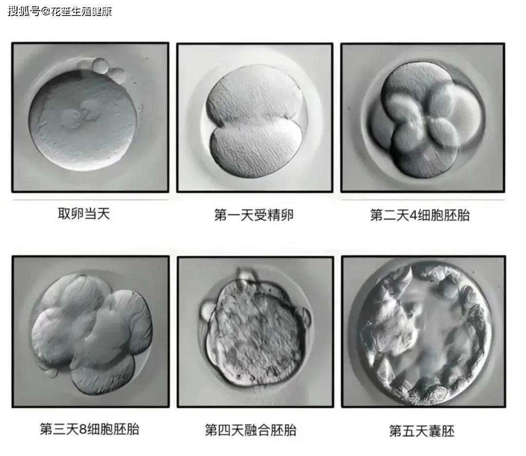 厦门试管婴儿机构:花笙生殖告知大家胚胎质量等级,了解更多试管助孕