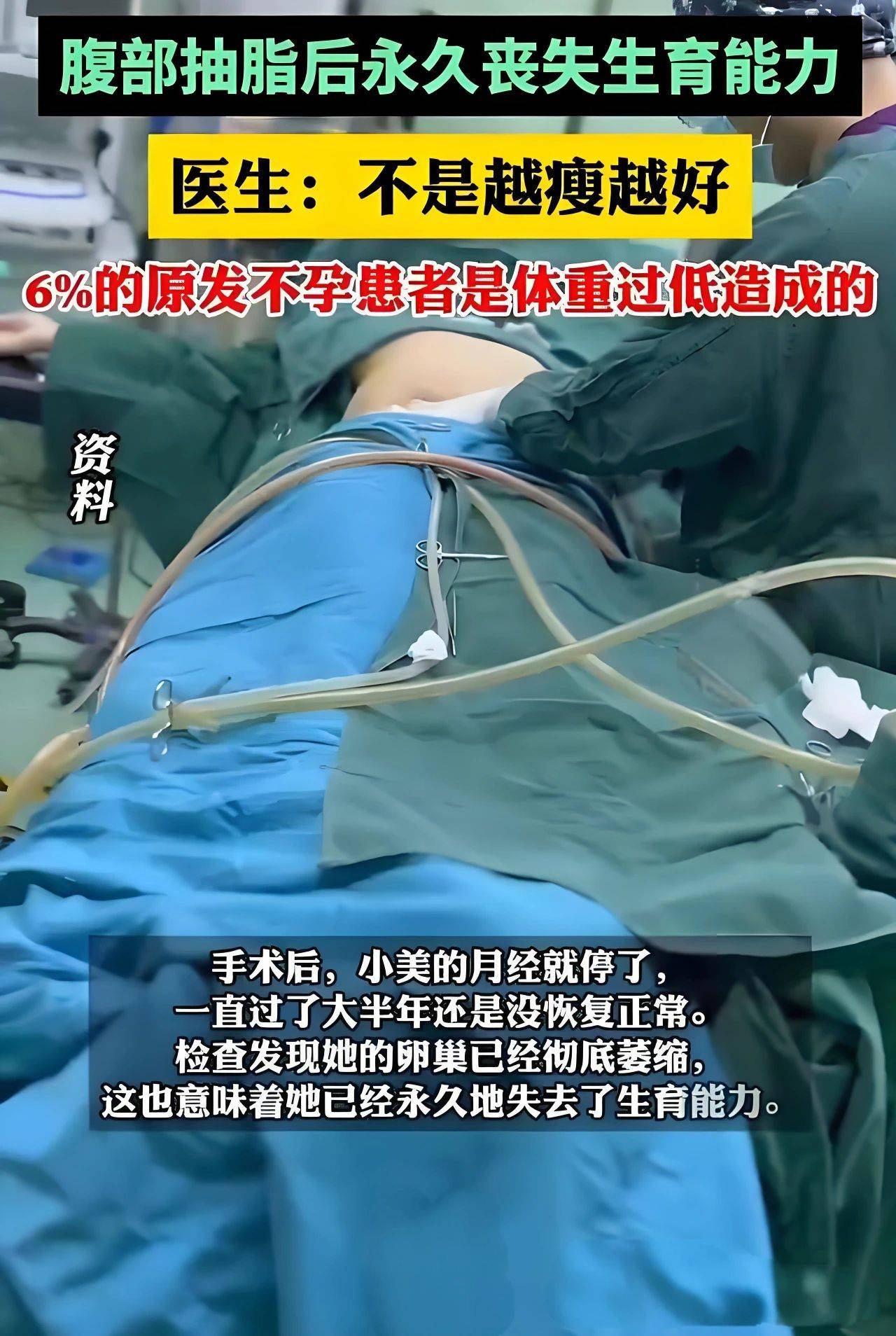 25岁女孩腹部抽脂永久丧失生育能力,瘦身之路暗藏多少风险？