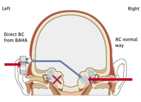 开放式耳机对耳朵好吗?开放式耳机哪个品牌好?