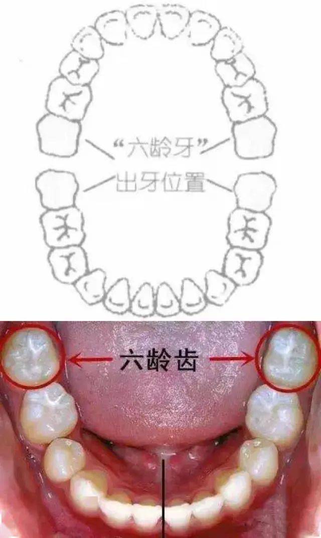 6龄齿图片大全图图片