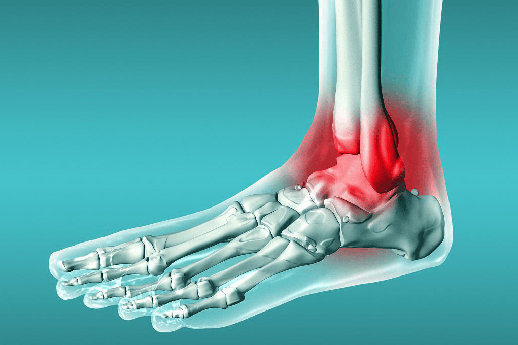 踝关节的功能锻炼