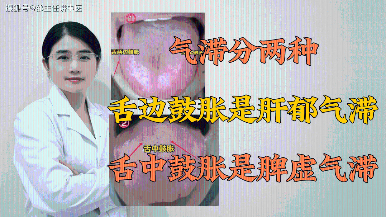 气滞分两种,舌边鼓胀是肝郁气滞,舌中鼓胀是脾虚气滞