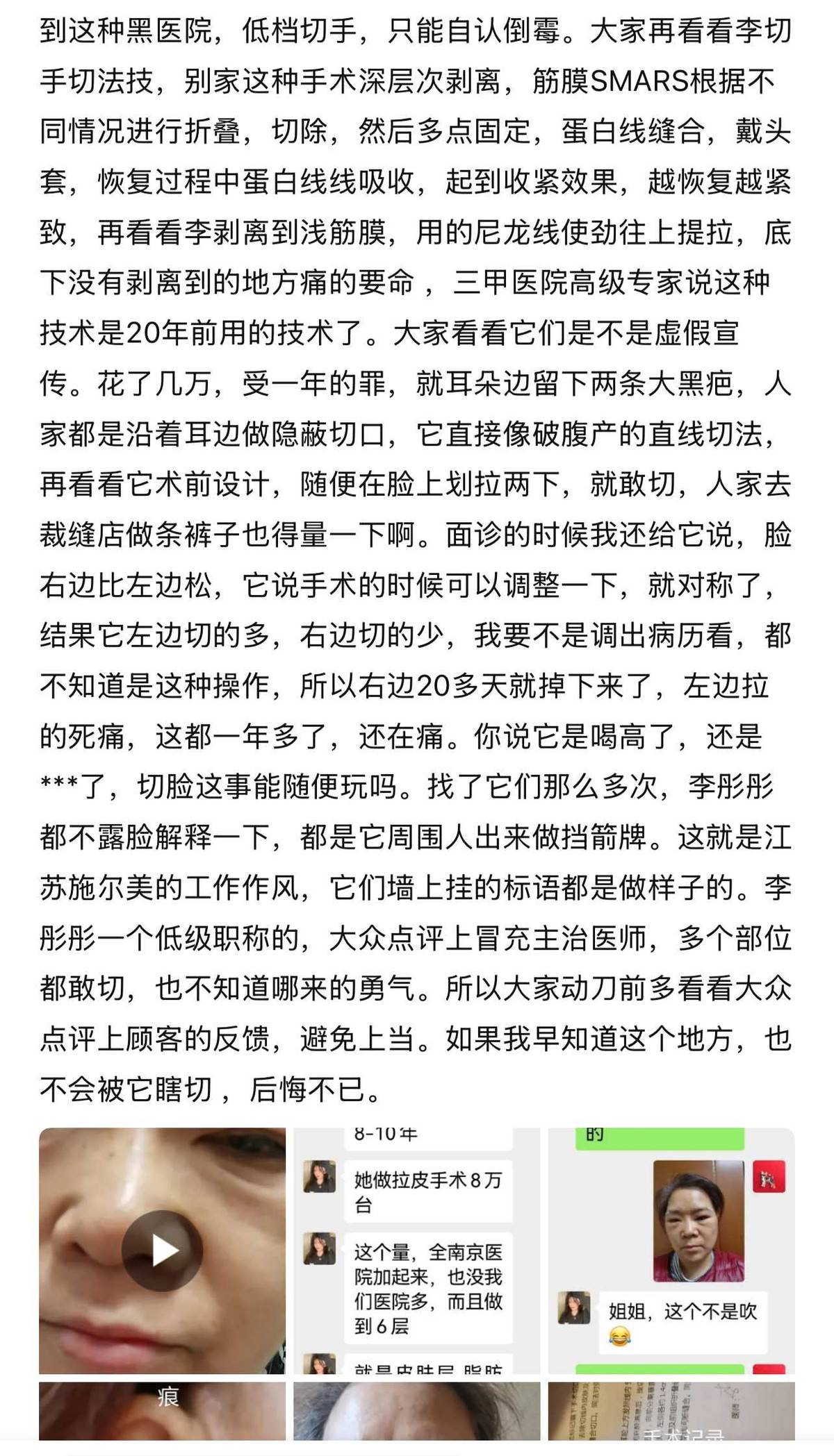 消费者手术悄悄被降级 施尔美整形吹太离谱算不算虚假宣传?(图14)