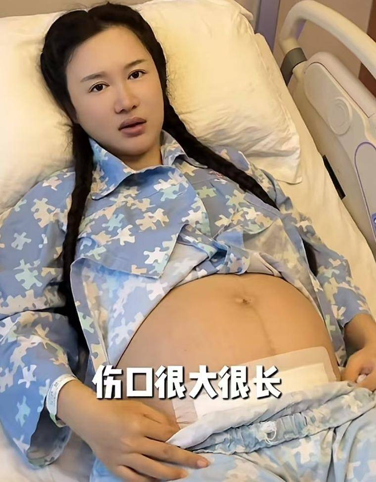 张纪中老婆面相图片