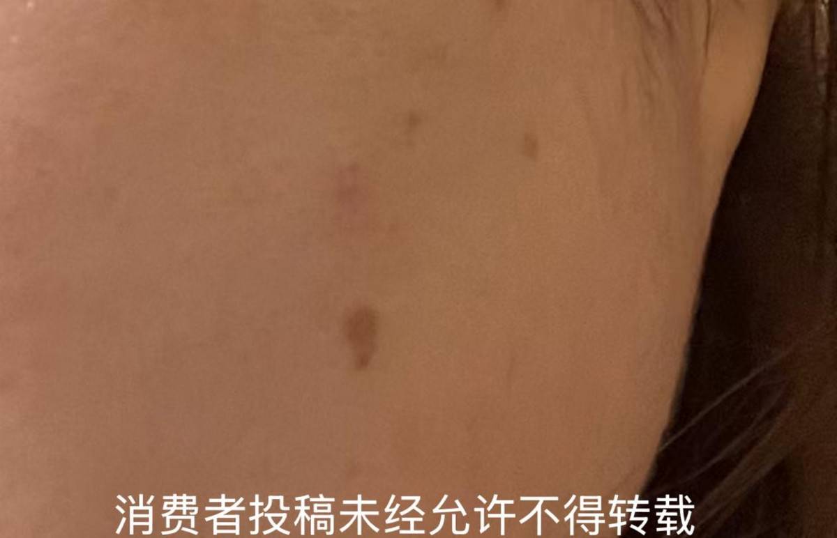 违规注射针剂后关门 南京秦淮芳华悦初医美是一家什么机构?(图14)