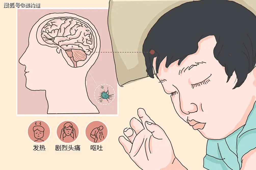 流脑卡通图片图片