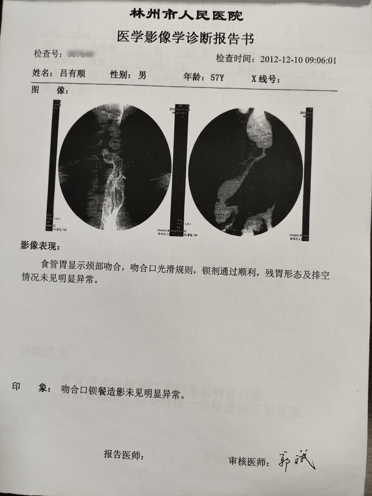 食道癌做什么检查图片