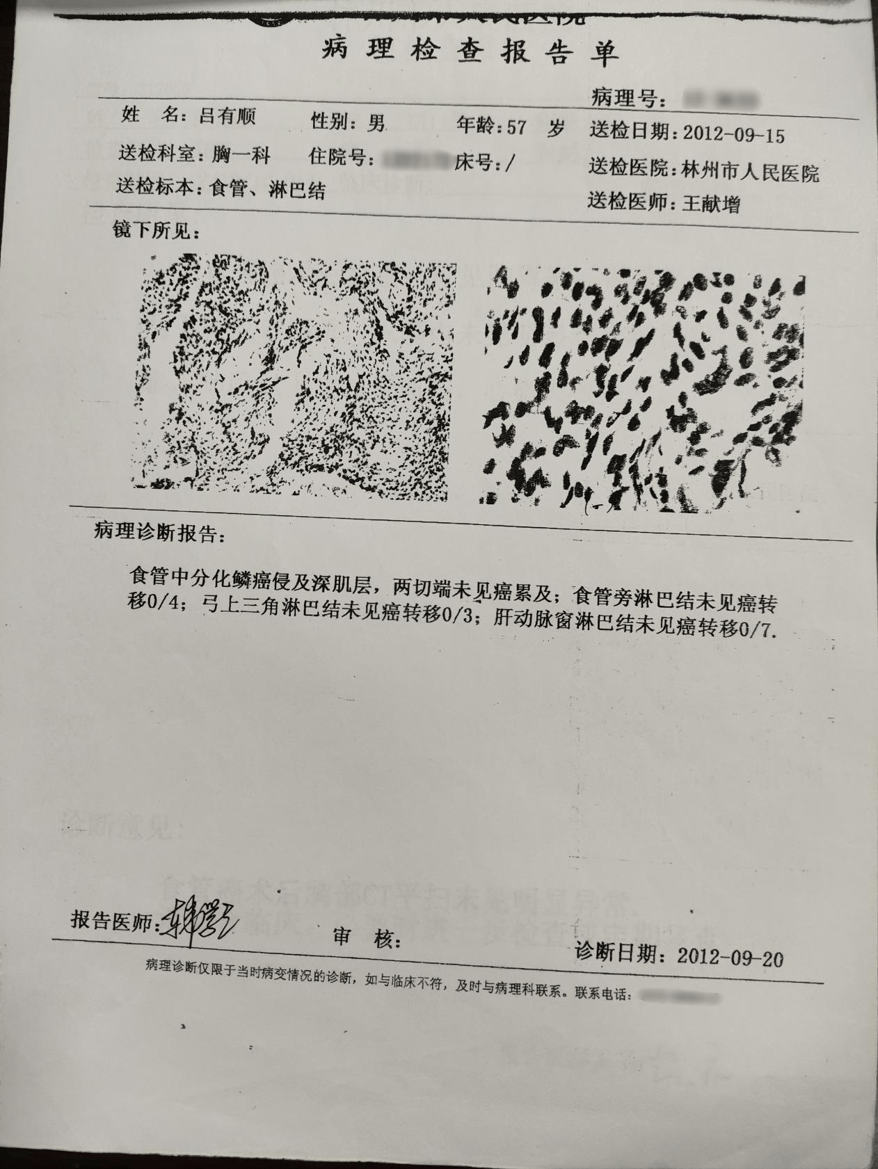 食道癌病理报告图片