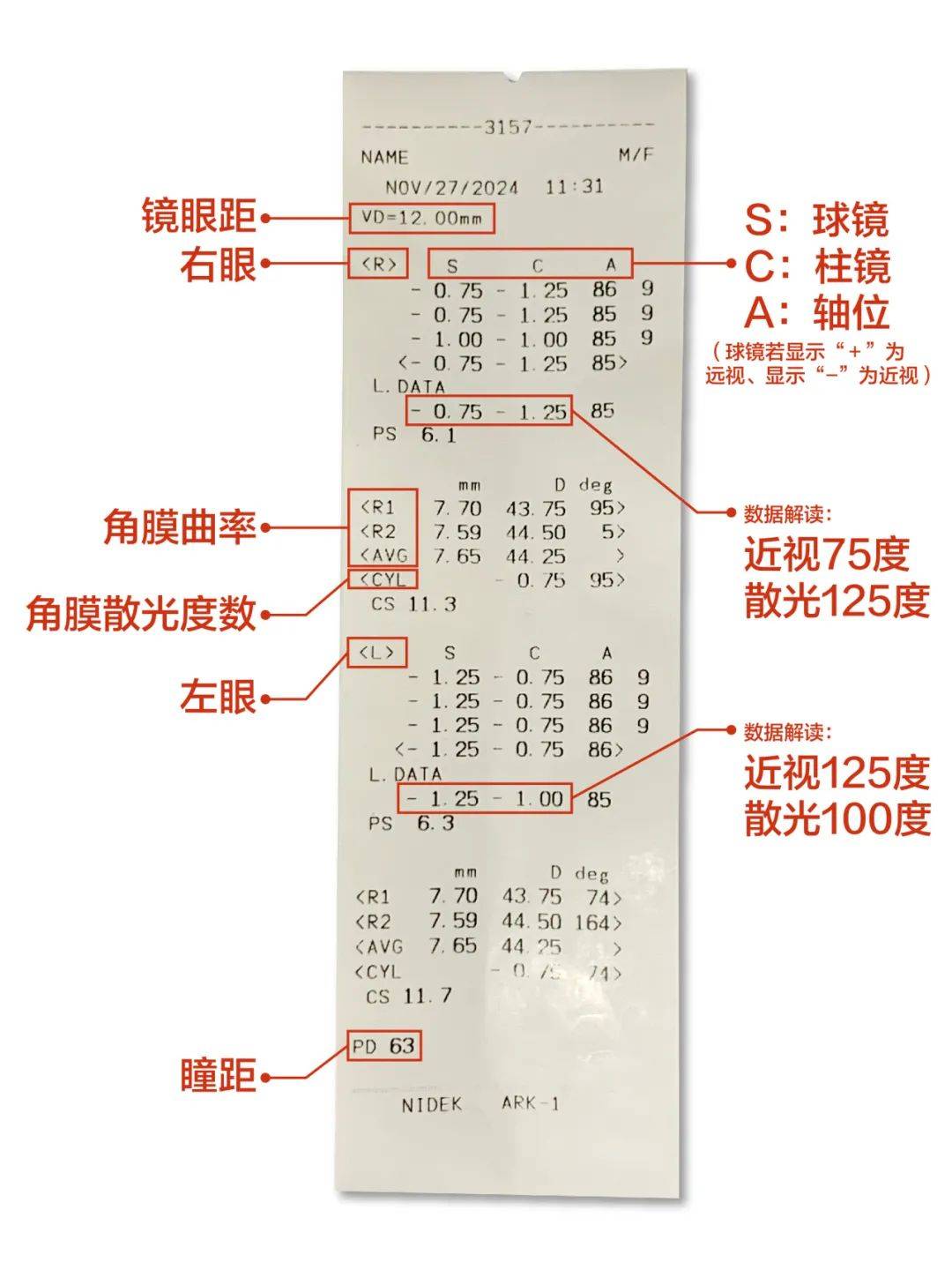 代表是近视c柱镜平常咱们看的散光度数a