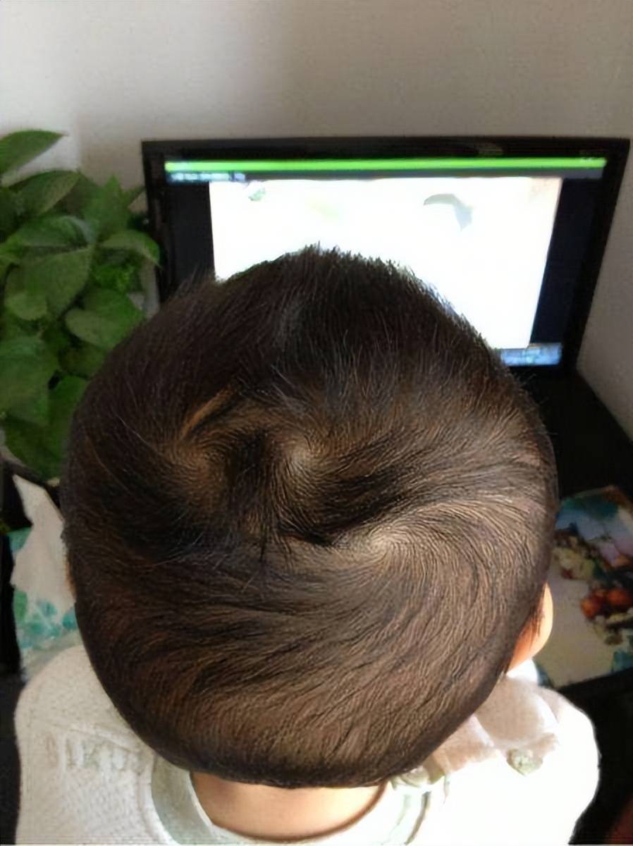 孩子头顶"几个旋"到底意味着什么?不少父母不懂,建议都看看