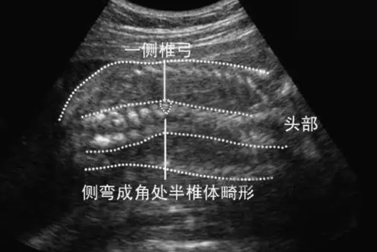 熬夜对孕妇的危害有多大？三个危害哪个都不轻