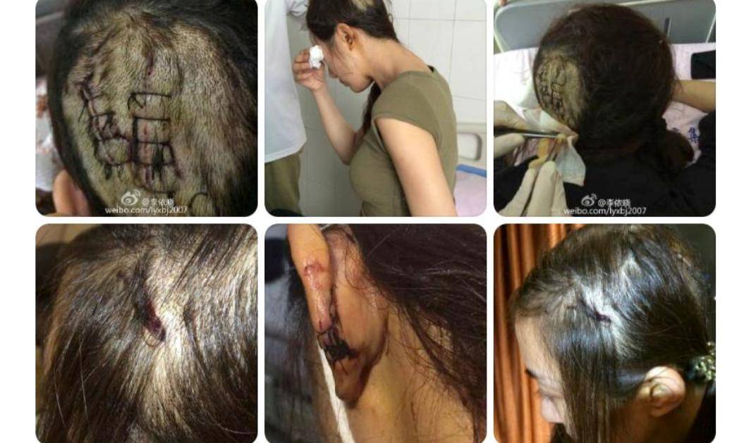 李依晓:被誉为内娱第一妲己,被狗咬毁容后,只能演蛇蝎毒妇